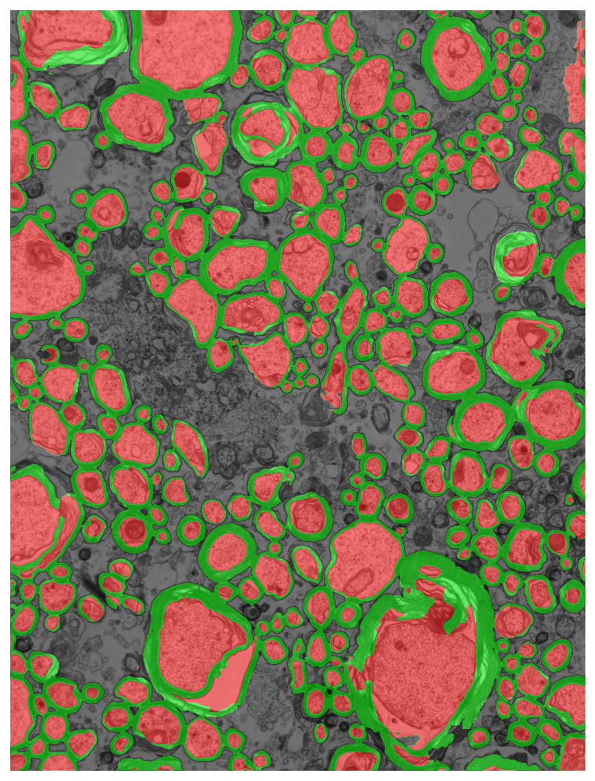 Segmentation overlay