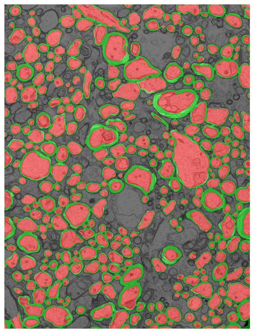 Segmentation overlay