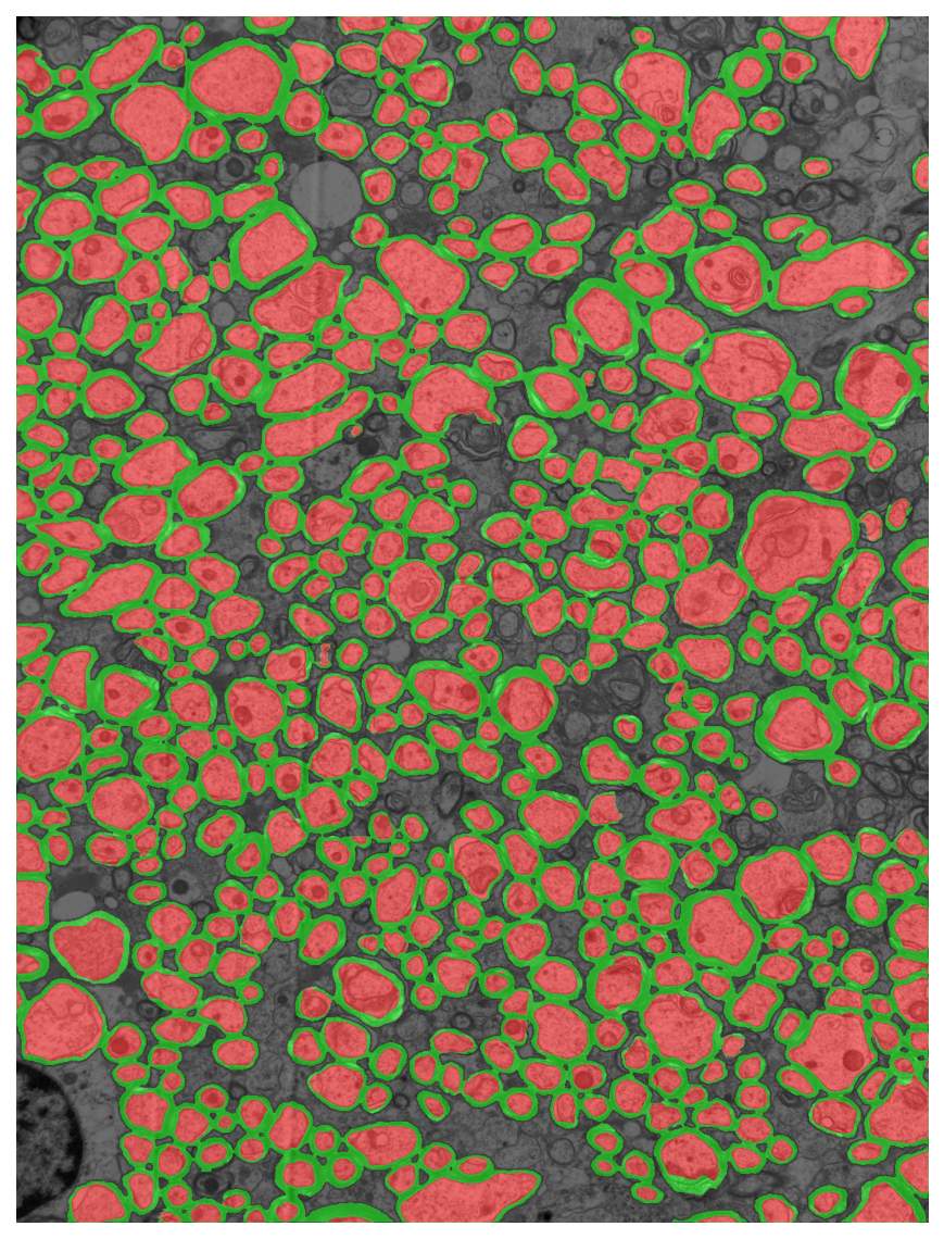 Segmentation overlay