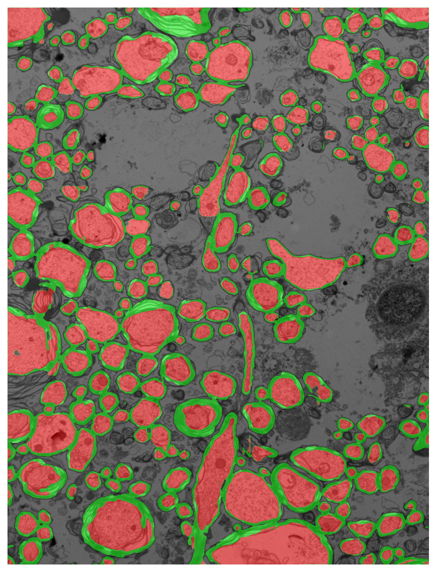 Segmentation overlay