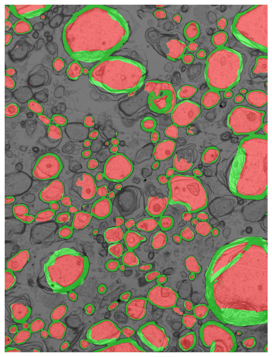 Segmentation overlay