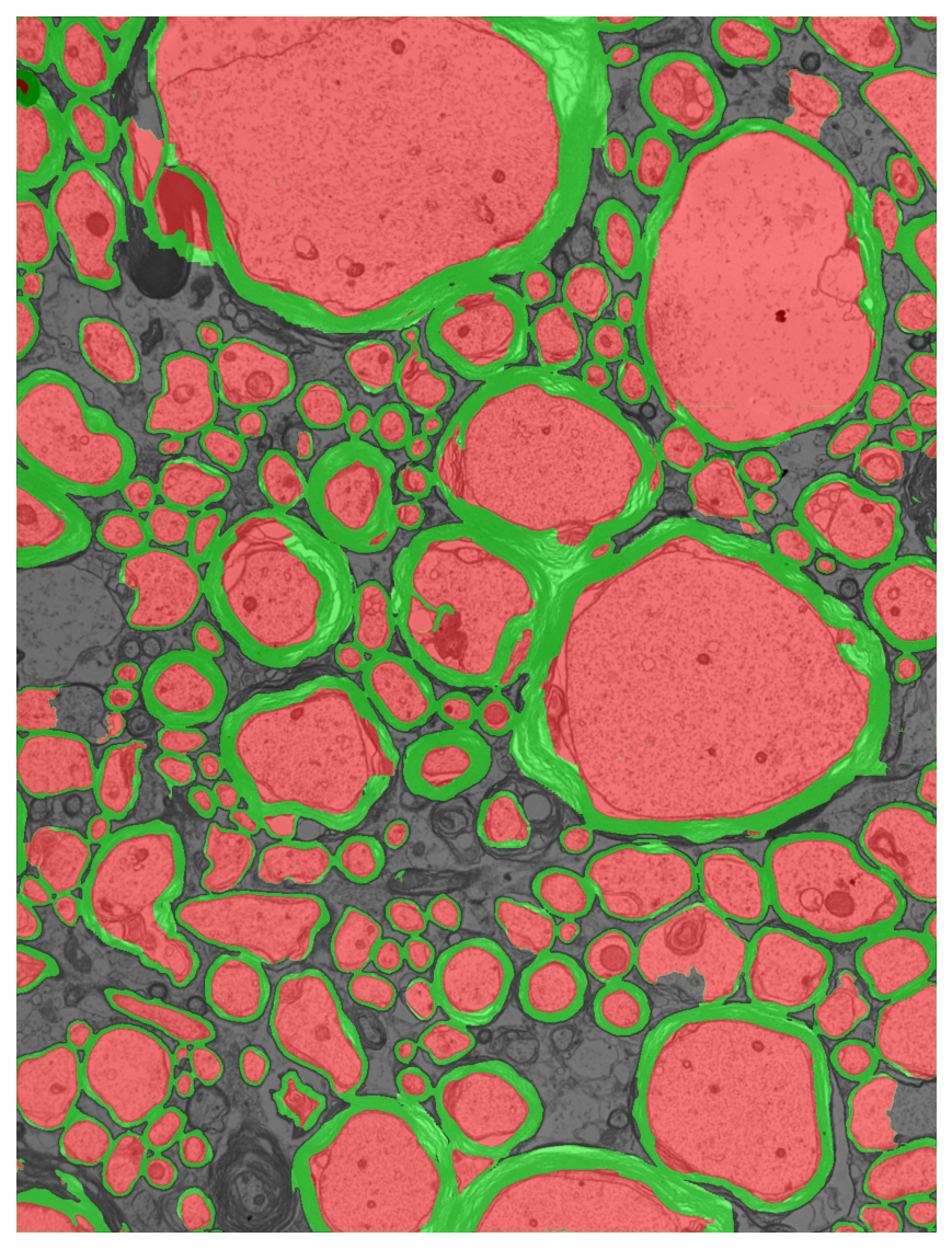 Segmentation overlay