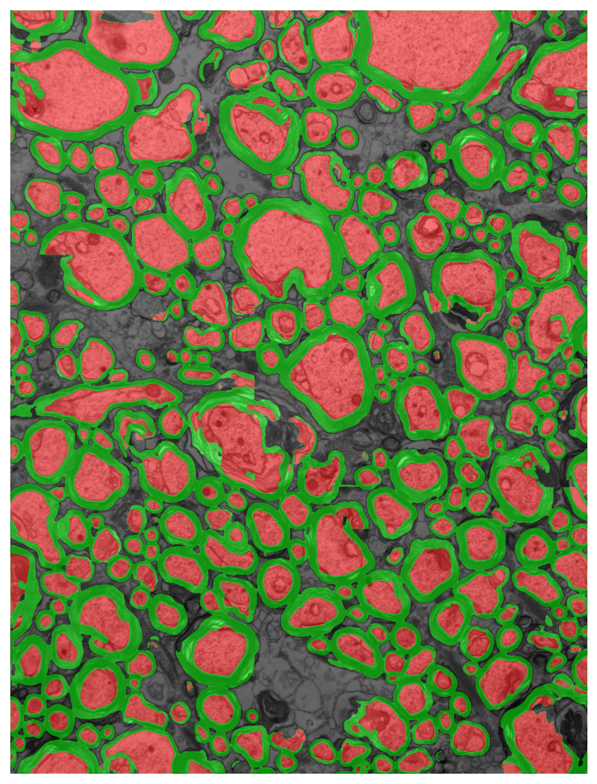 Segmentation overlay