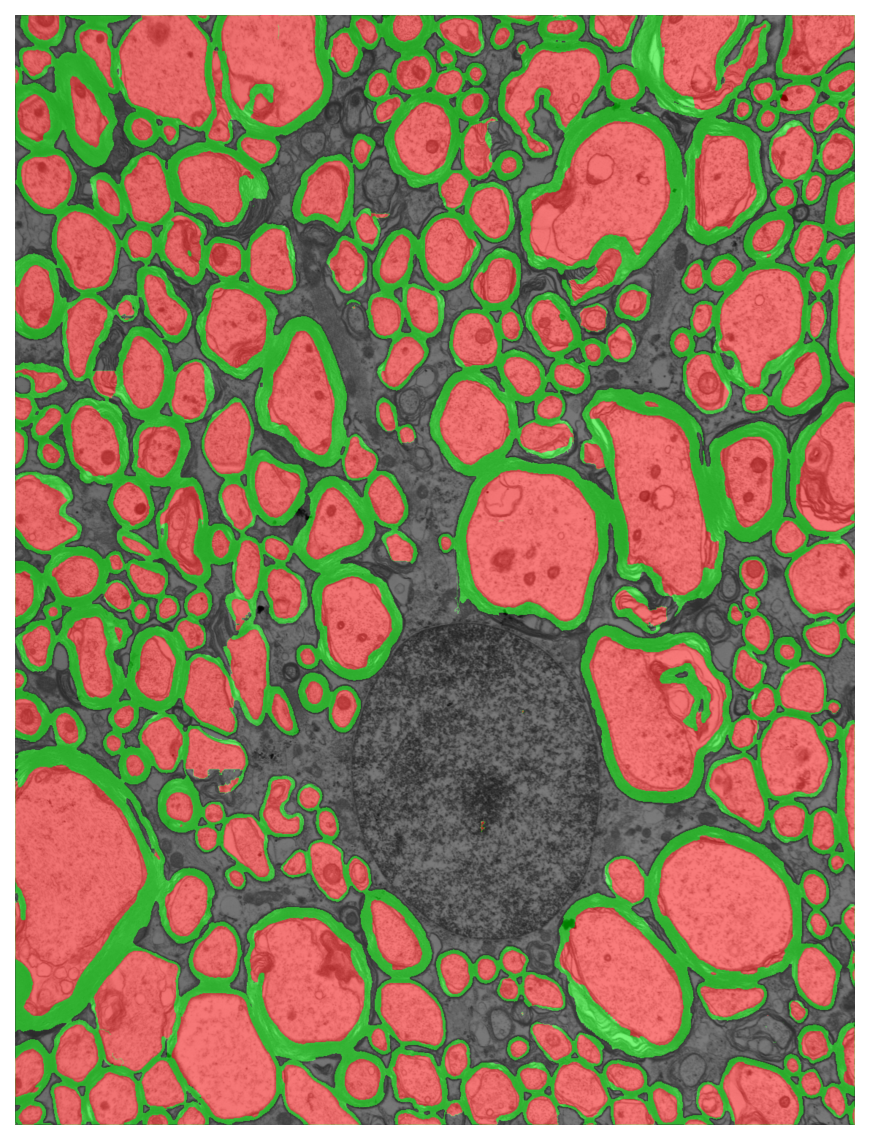 Segmentation overlay