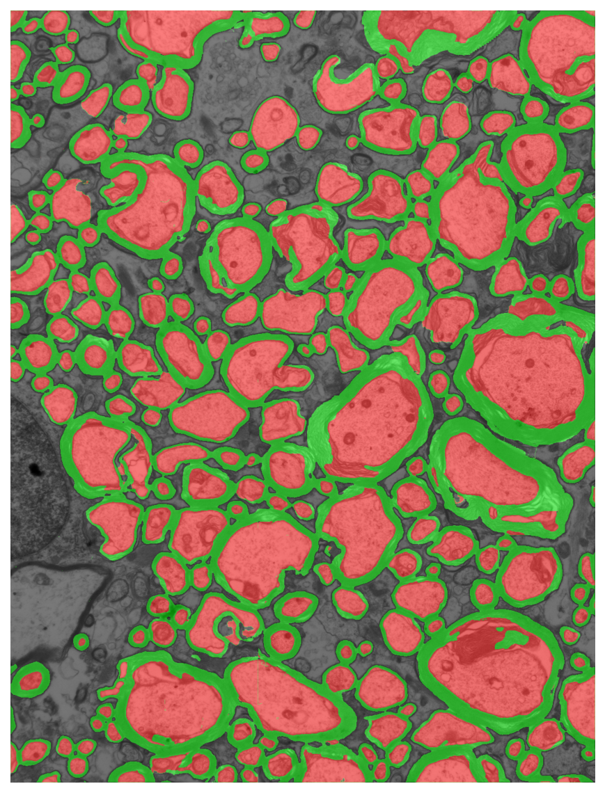 Segmentation overlay