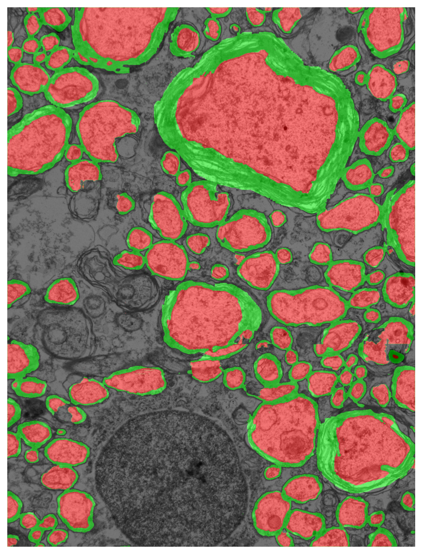 Segmentation overlay