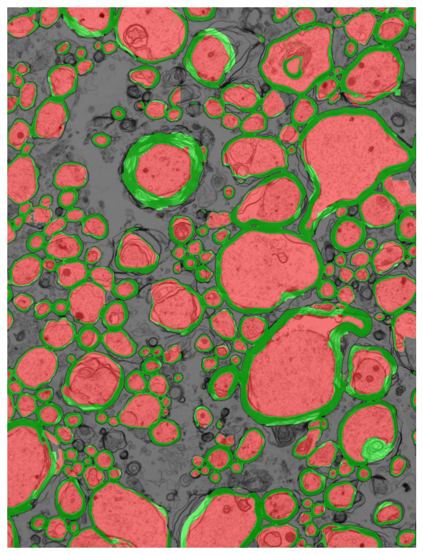 Segmentation overlay