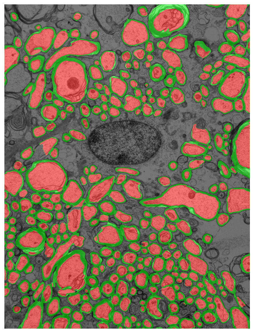 Segmentation overlay