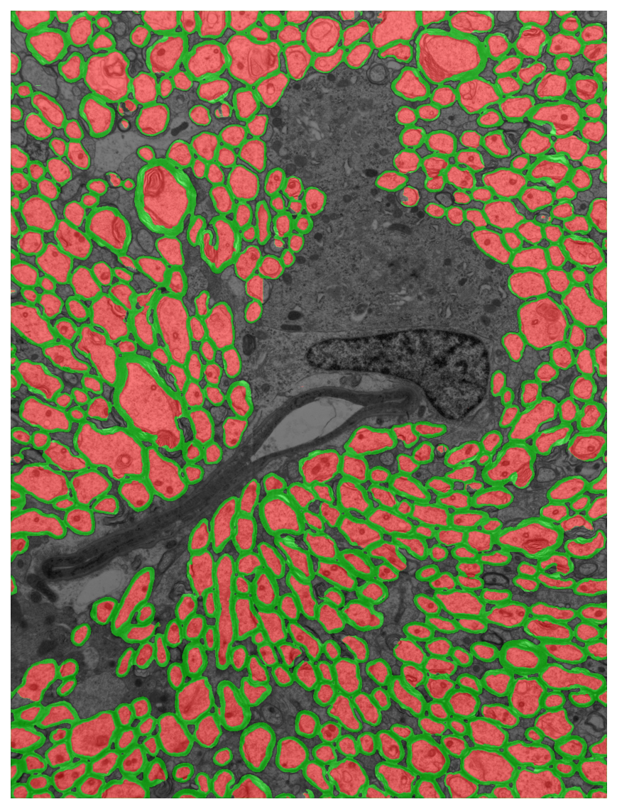 Segmentation overlay