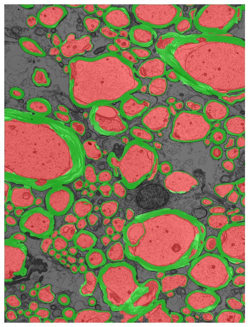 Segmentation overlay
