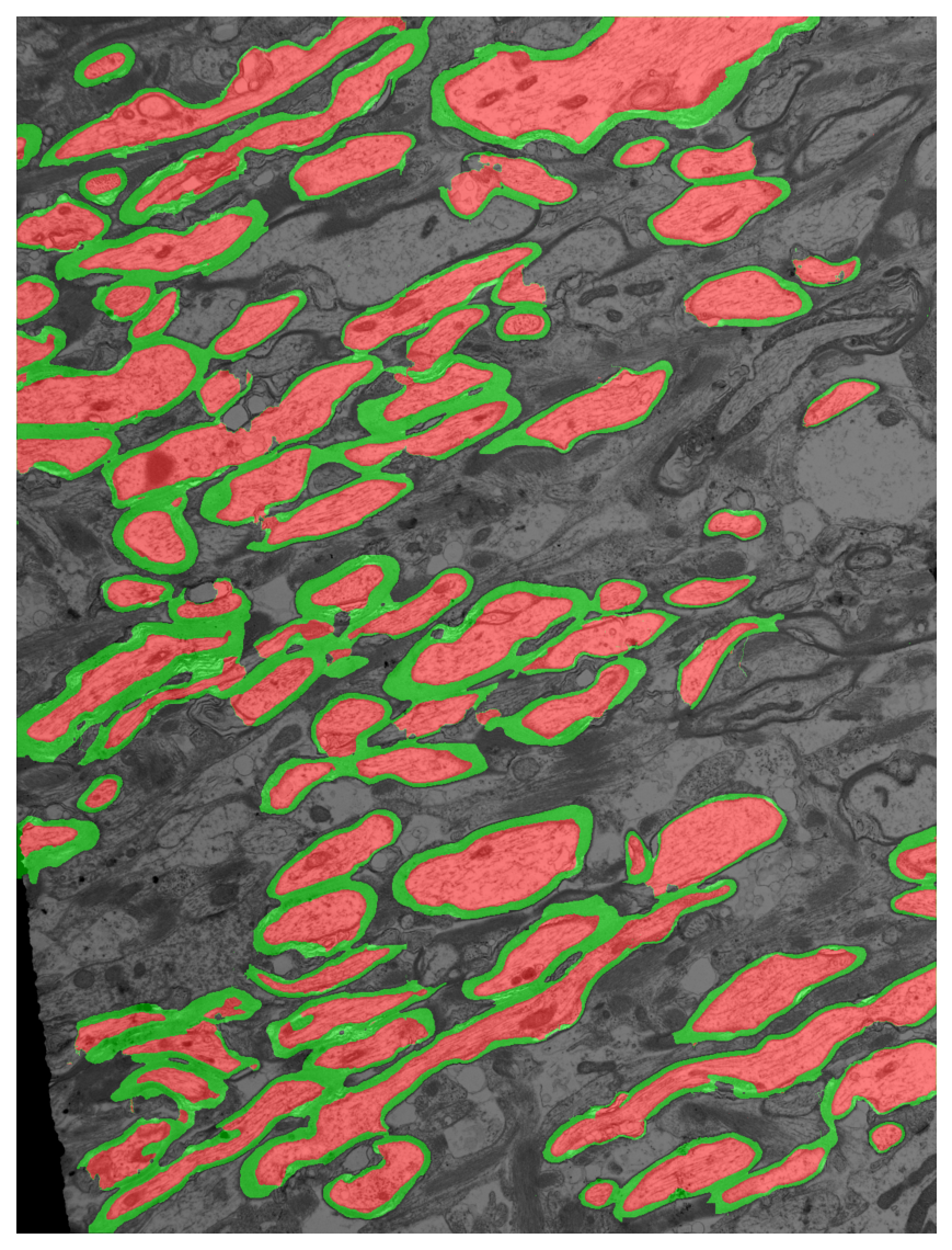 Segmentation overlay