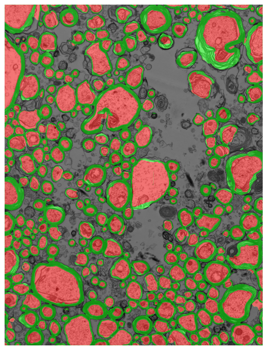 Segmentation overlay