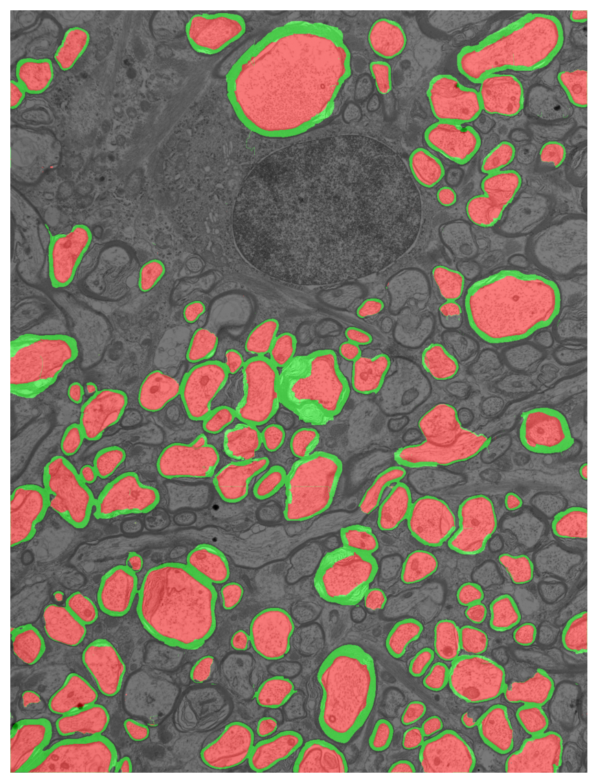 Segmentation overlay