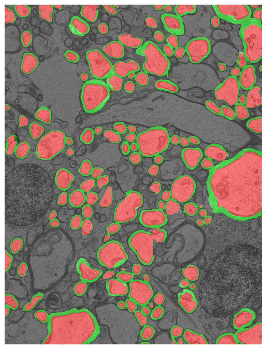 Segmentation overlay