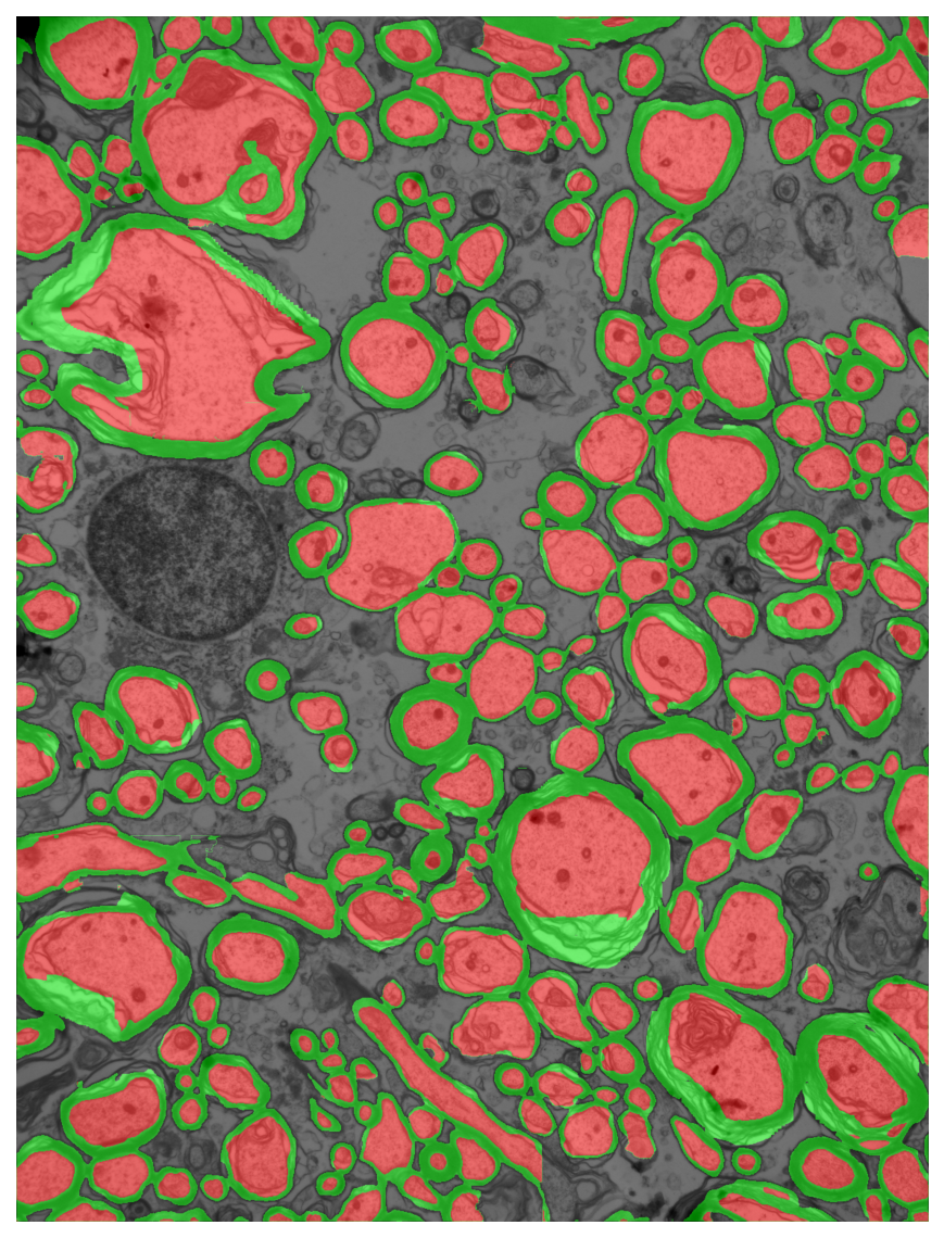 Segmentation overlay