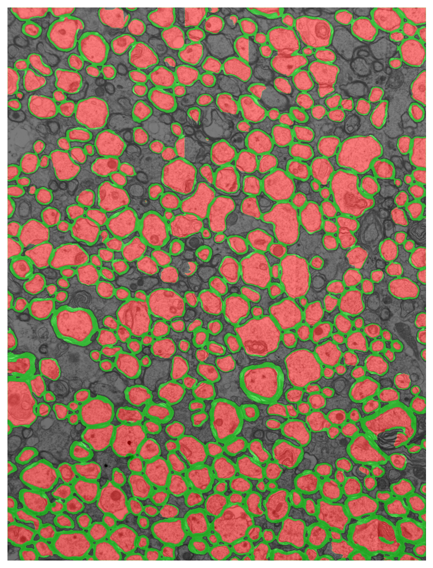 Segmentation overlay