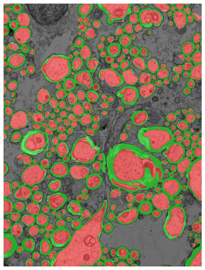 Segmentation overlay