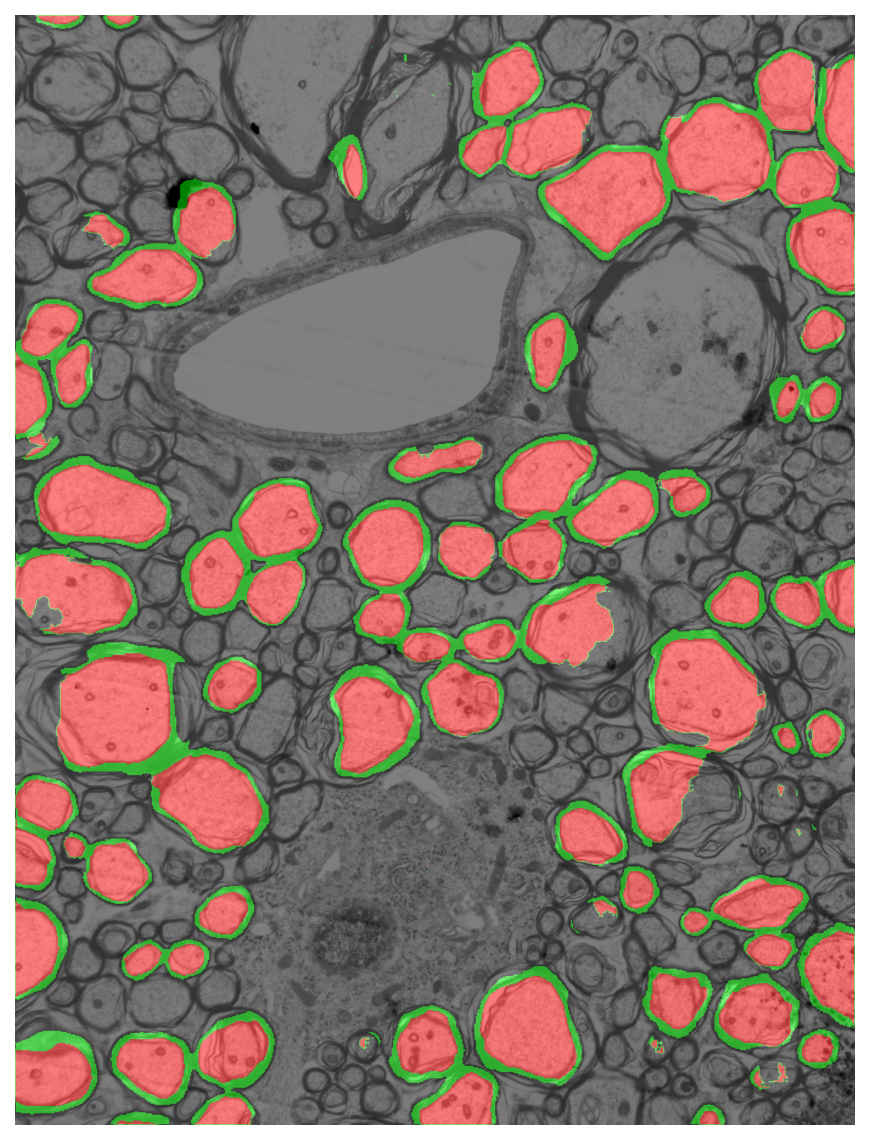 Segmentation overlay