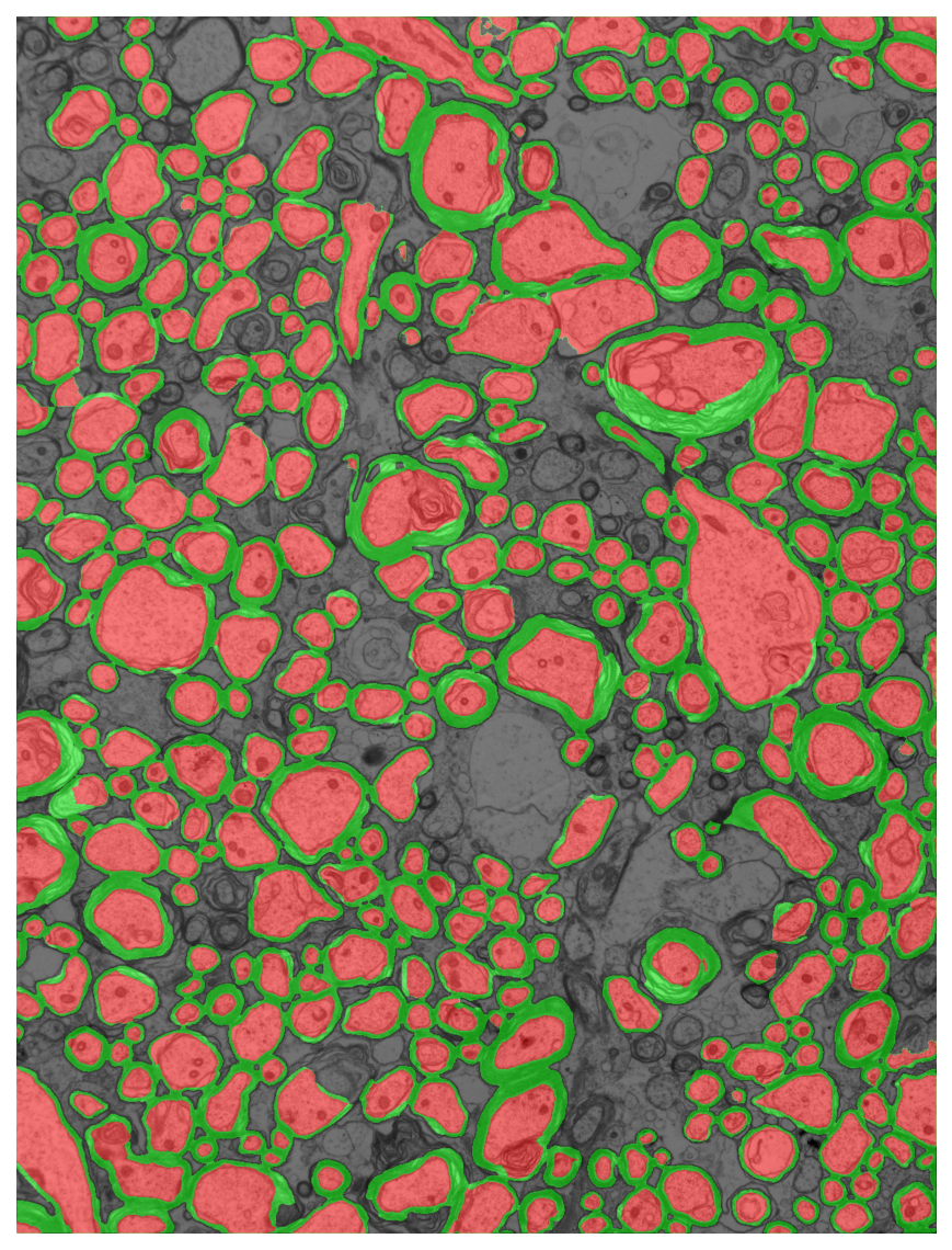Segmentation overlay