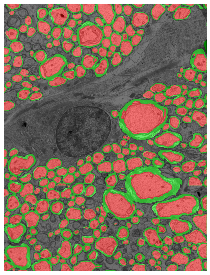 Segmentation overlay